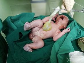 引产小孩吃瓜,瓜田里的沉默与反思